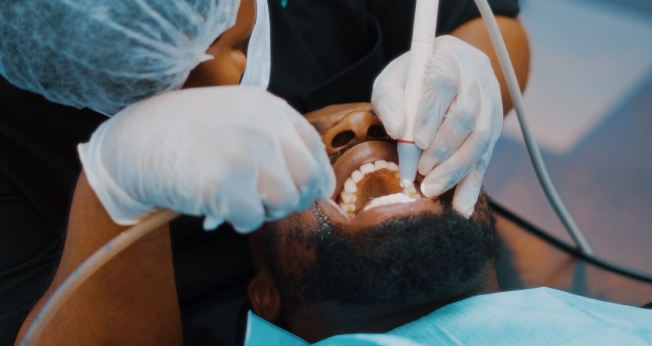 Painless Dental Treatment in Coimbatore