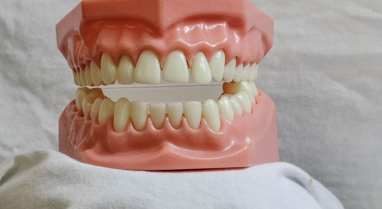 Top 7 Reasons Patients in Sungam Choose Skyc Line Dental for Dental Care