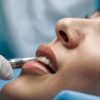 Teeth-Alignment-treatment-and-cost-in-Coimbatore