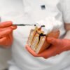 root canal