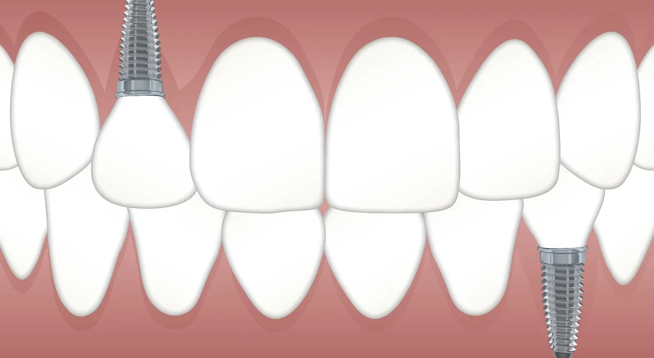 artificial teeth
