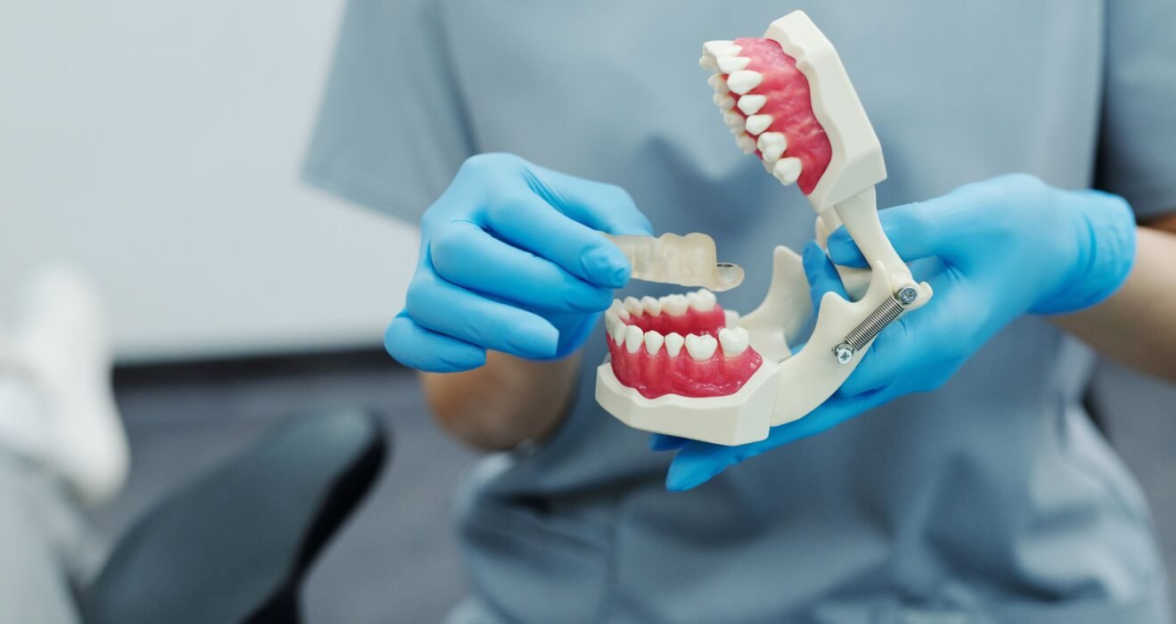 Teeth aligner