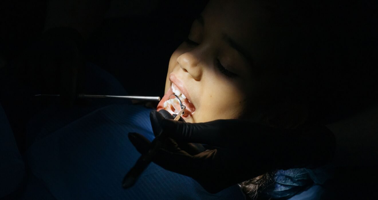 Tooth Removal