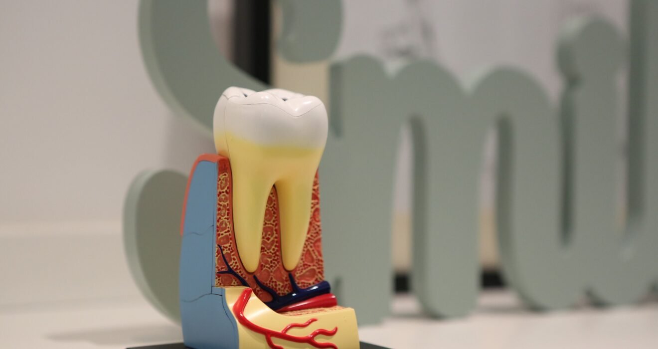 root canal