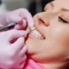 teeth whitening