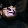 laser